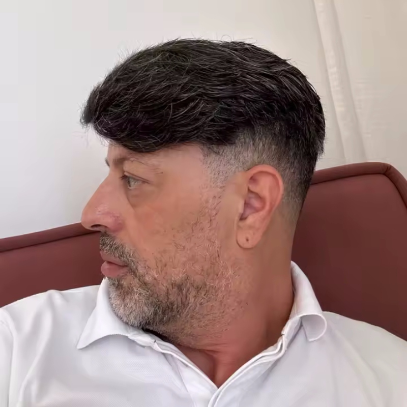 Die Haarlinie ist richtig gut gemacht.