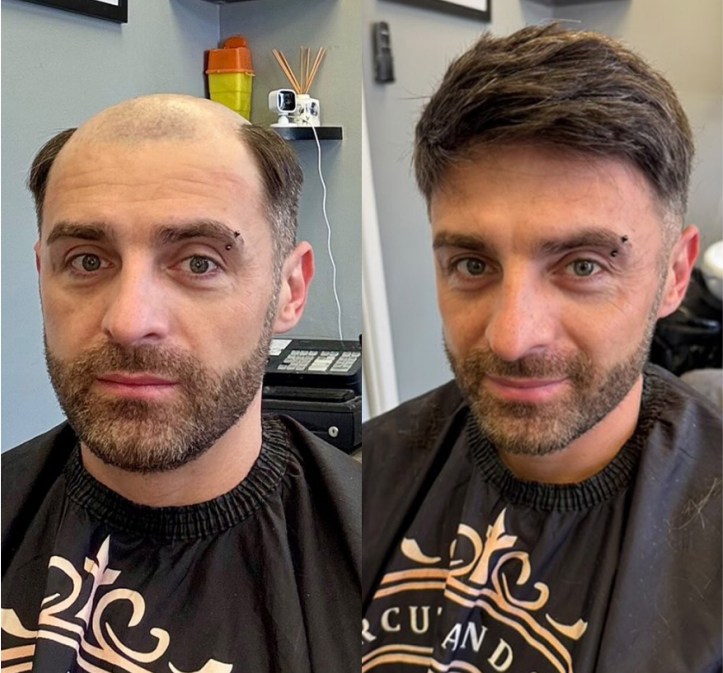 0608V|0.06-0.08 mm V - Loop | Bio - Skin - Haarsystem für Männer | Kein Glanz bei Licht, Paßt gut zu Ihrer Haut